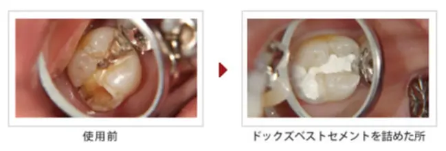 使用前→ドッグズベストセメントを詰めた所