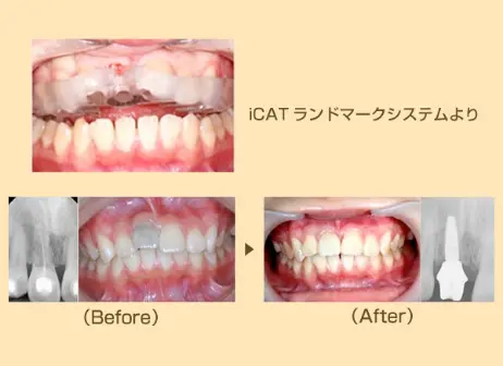 iCAT ランドマークシステムより｜（Before）→（After）